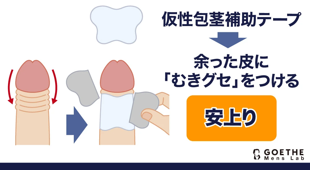 仮性包茎補助テープ→余った皮に「むきグセ」をつける【安上り】