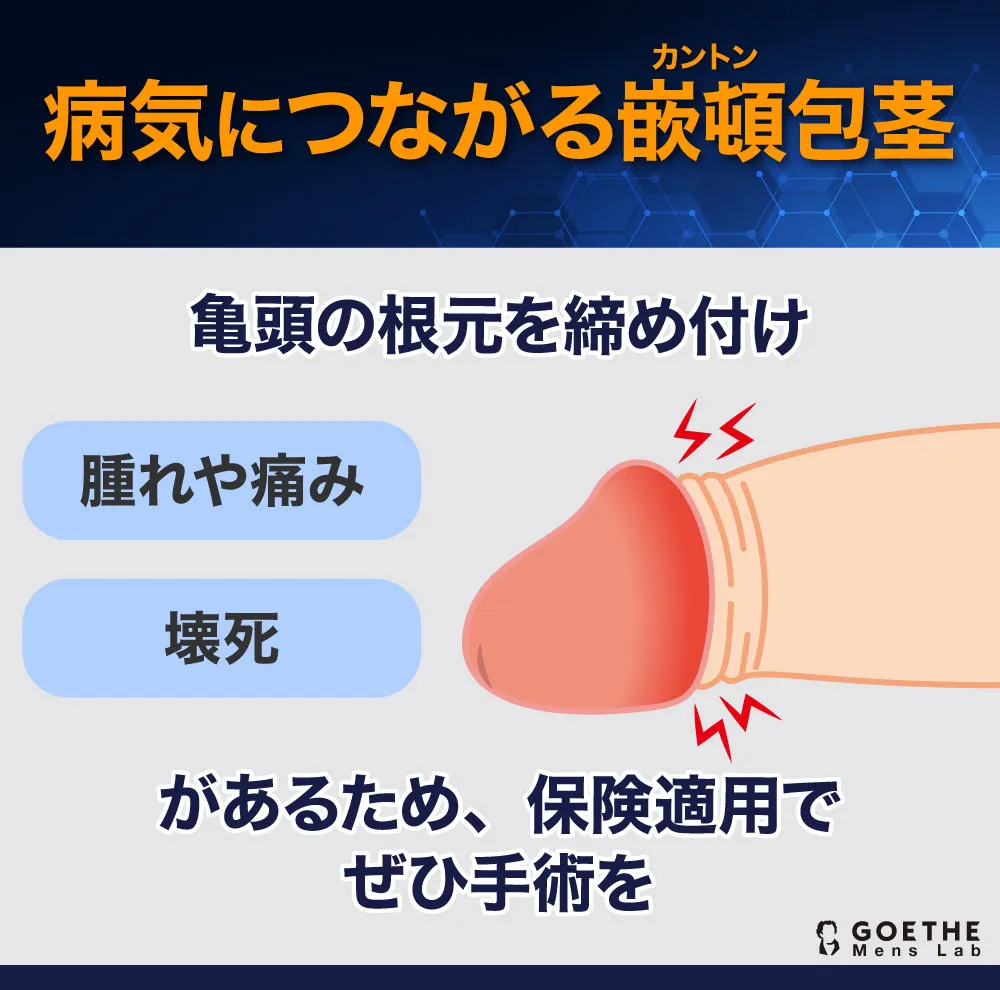 カントン