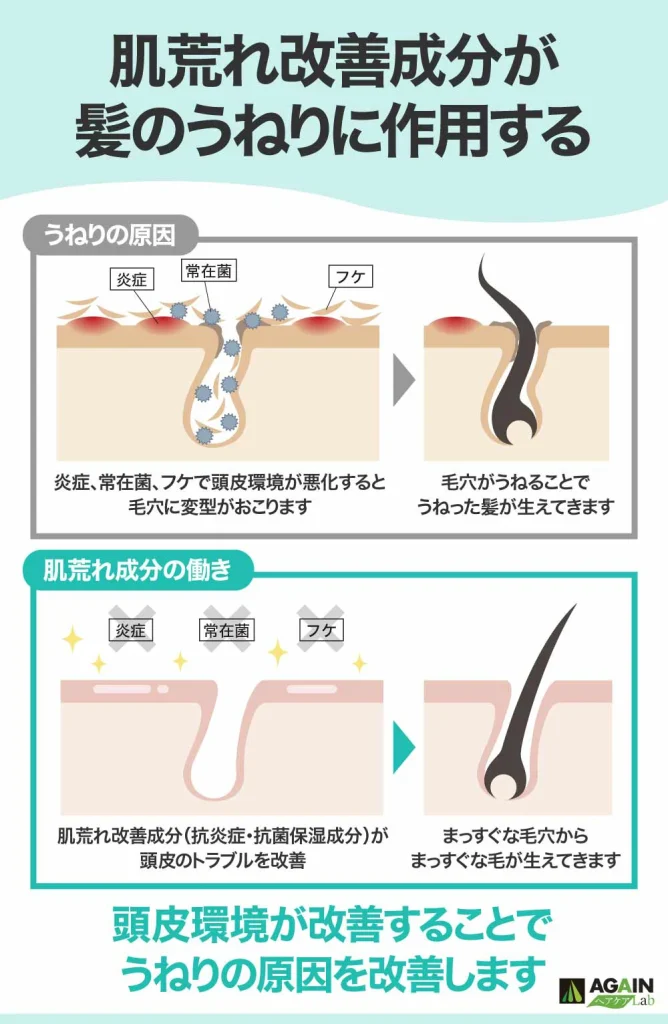 頭皮の肌荒れ防止でうねりを解消
