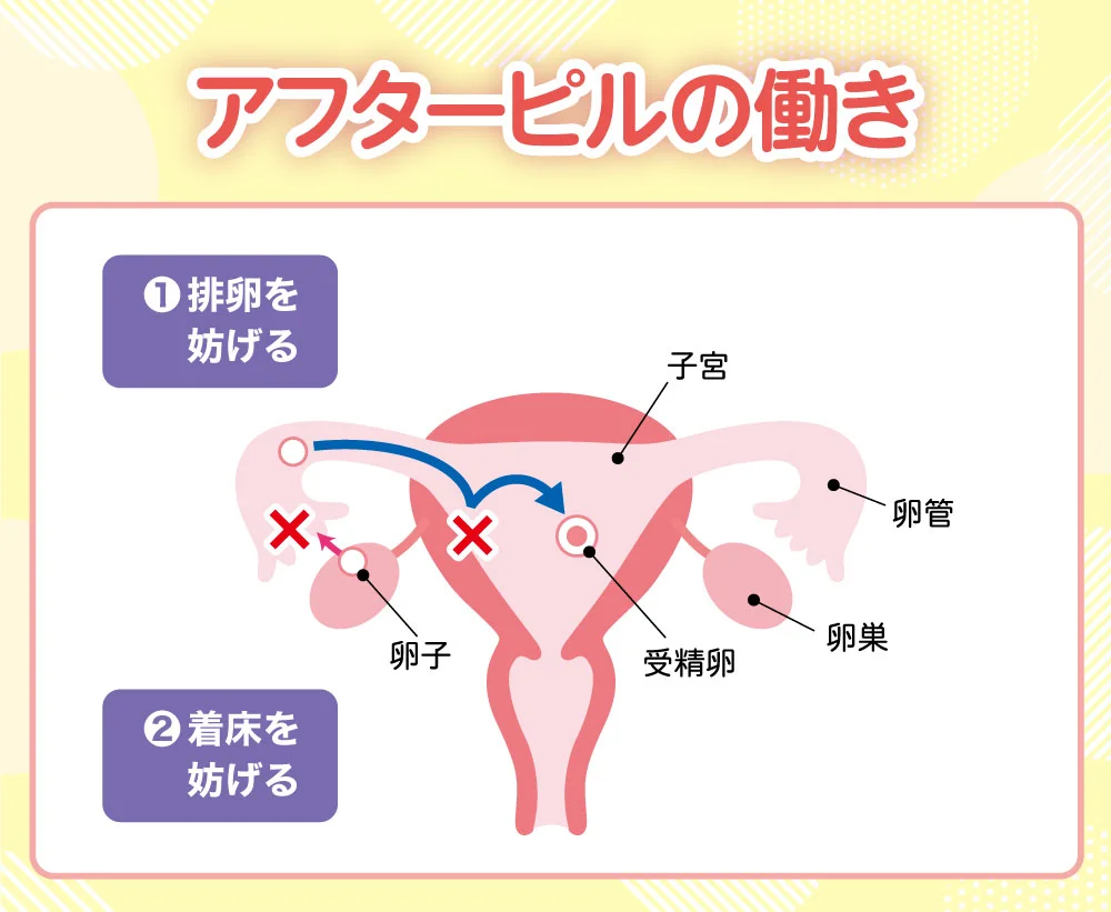 【アフターピルの働き】①排卵を妨げる②着床を妨げる