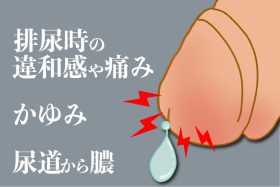 クラミジアの症状とは？男性に多い初期症状・原因・治療法を医師が解説