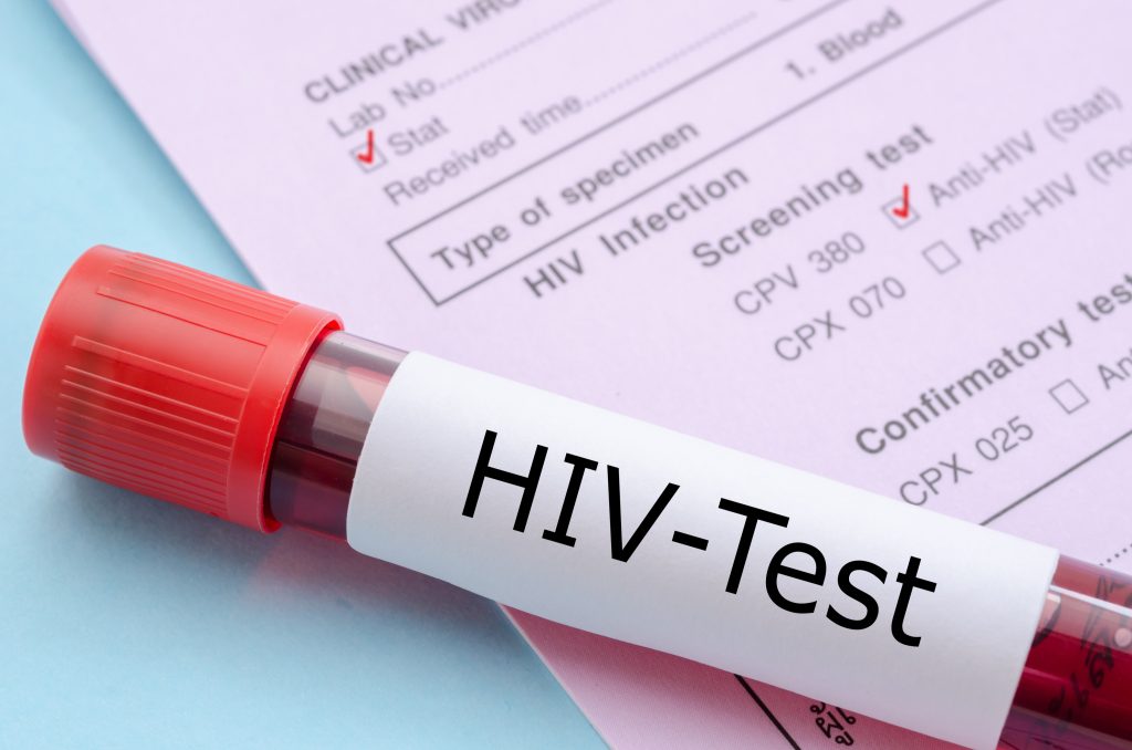 HIV検査について