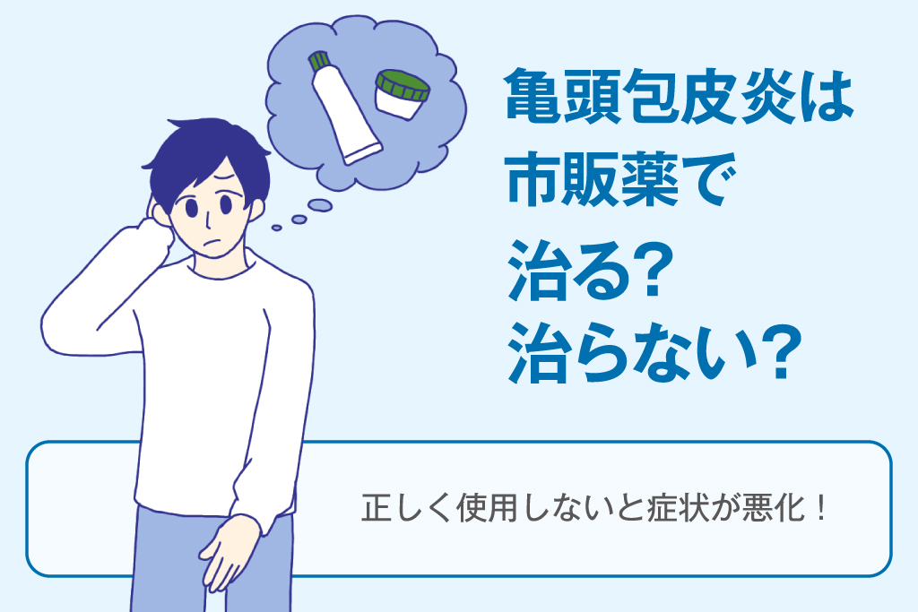 亀頭包皮炎は市販薬で治せる？|カンジダ性・細菌性それぞれの薬を解説